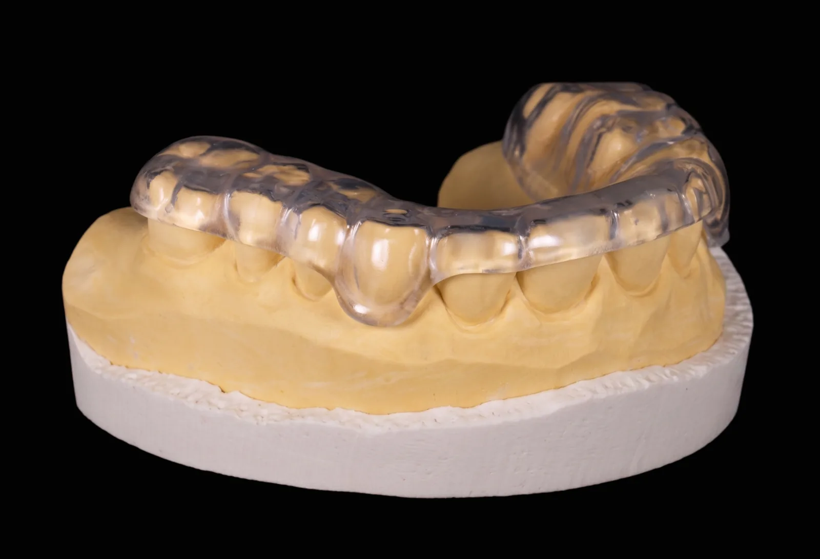 Custom nightguard / occlusal guard