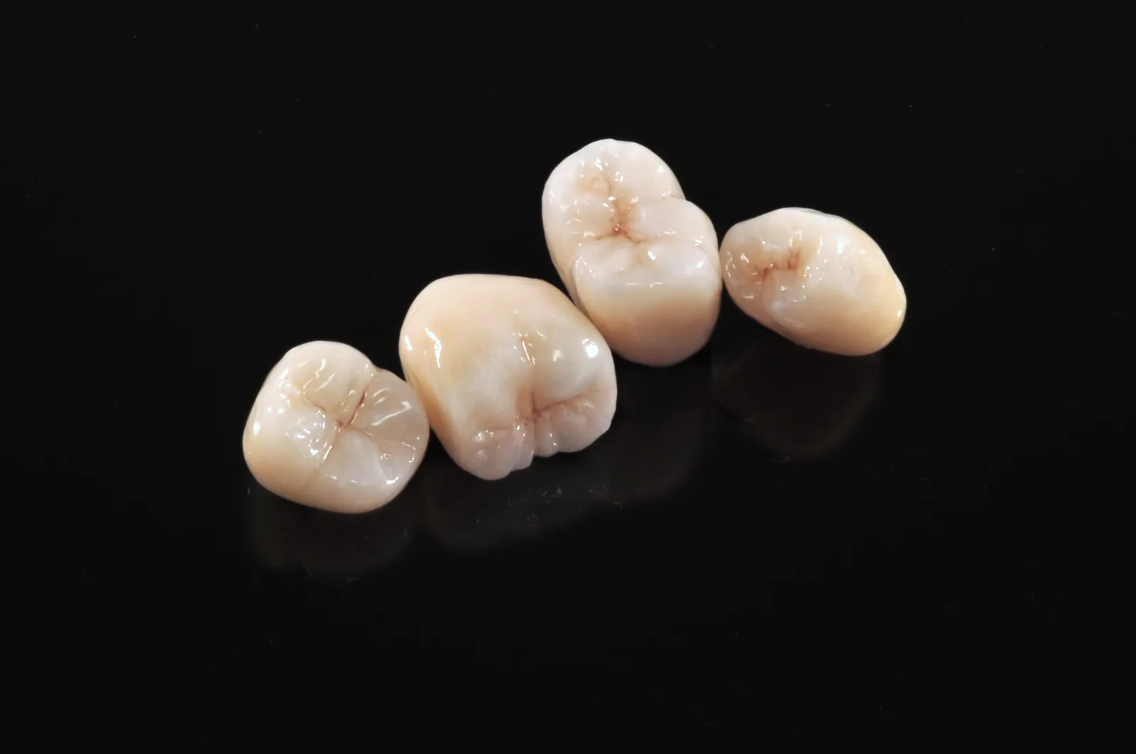 Posterior PureZi zirconia crown and bridge restoration